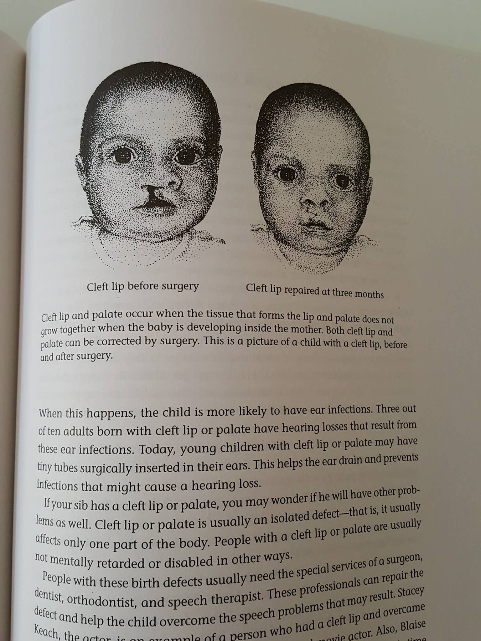 LIVING WITH A BROTHER OR SISTER WITH SPECIAL NEEDS