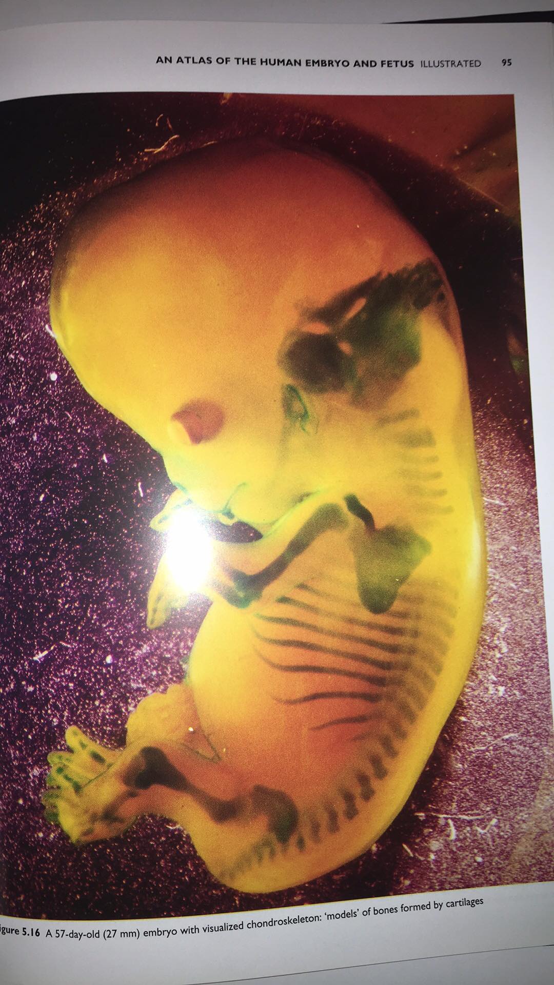 Jan E. Jirásek -An Atlas of the Human Embryo and Fetus