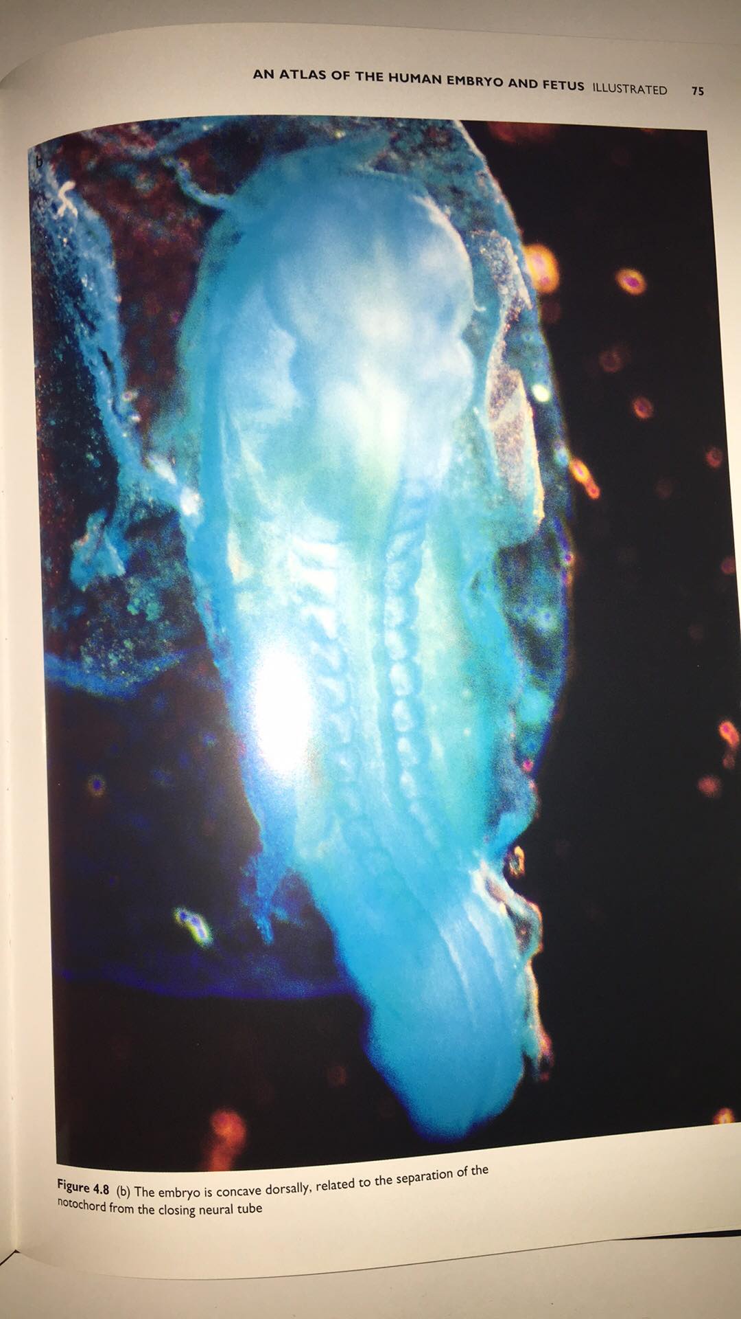 Jan E. Jirásek -An Atlas of the Human Embryo and Fetus