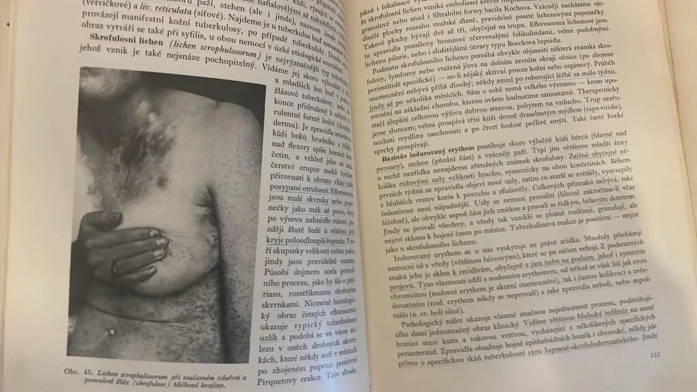 DR. ANTONÍN TRYB - PRAKTICKÁ DERMATOLOGIE