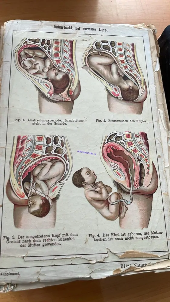 BILZOVO NOVÉ LÉČENÍ
